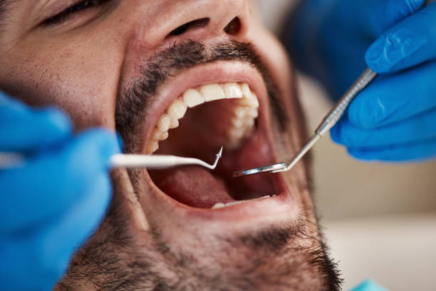 Best Emergency Treatment for Toothache in Beverly, NJ